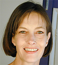 Facial Rejuvenation In UK